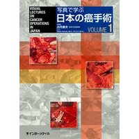 写真で学ぶ日本の癌手術〈VOLUME 1〉